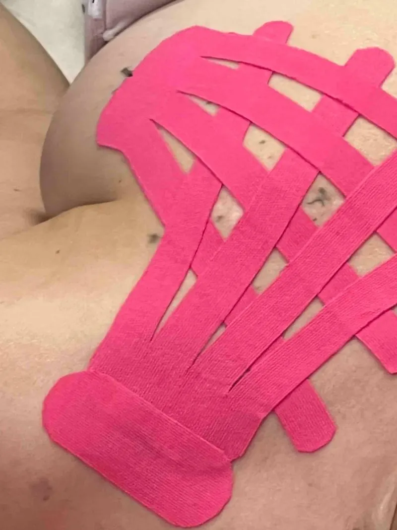 Lymfotaping v oblasti lopatky růžovým tejpem ve tvaru vějíře