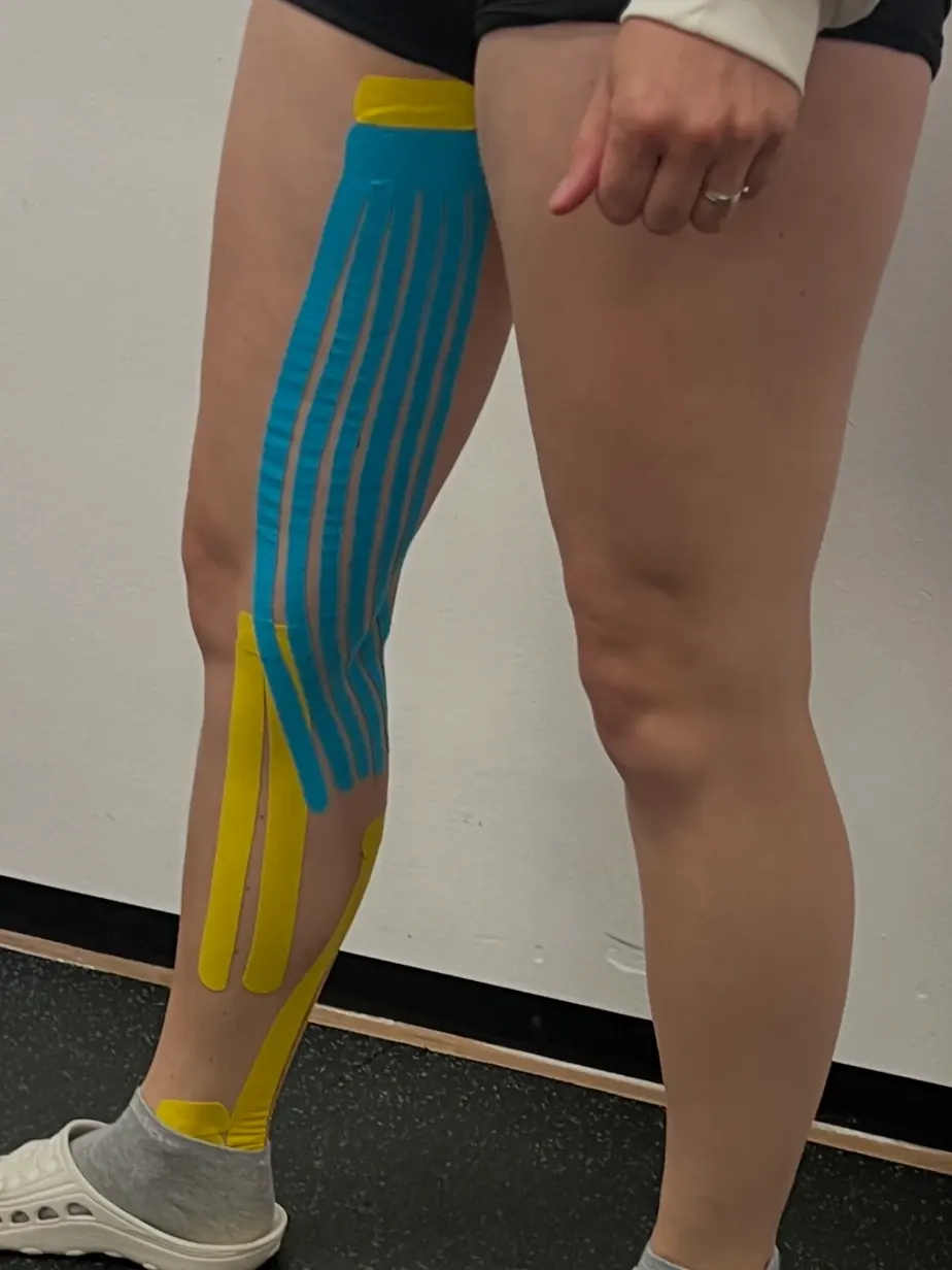 Kineziotaping stehna a lýtka modrým a žlutým tejpem